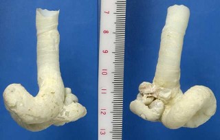 ハマカズラ Serpulorbis medusae small