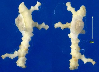 ニッポンマツワリダカラ Pedicularia japonica small